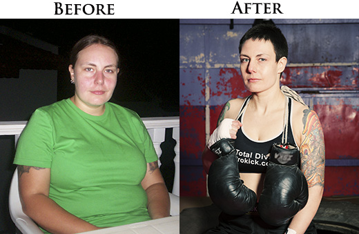 RUTH MCCORMACK before and after pictures