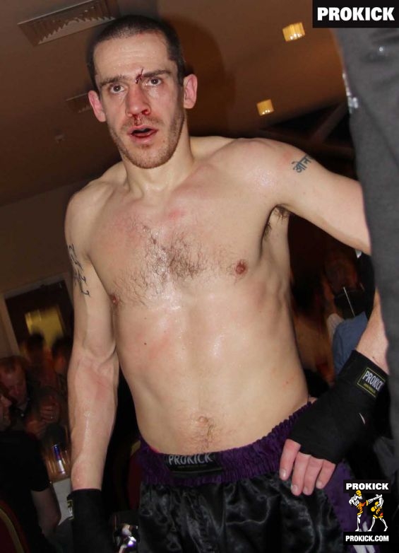 Foster after his title bout